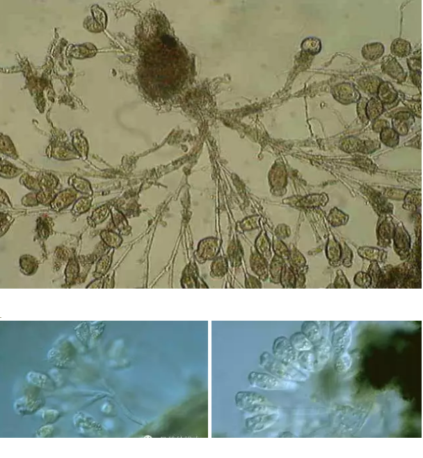 優質果殼濾料廠家污水處理指示性微生物大全!敏感者慎入