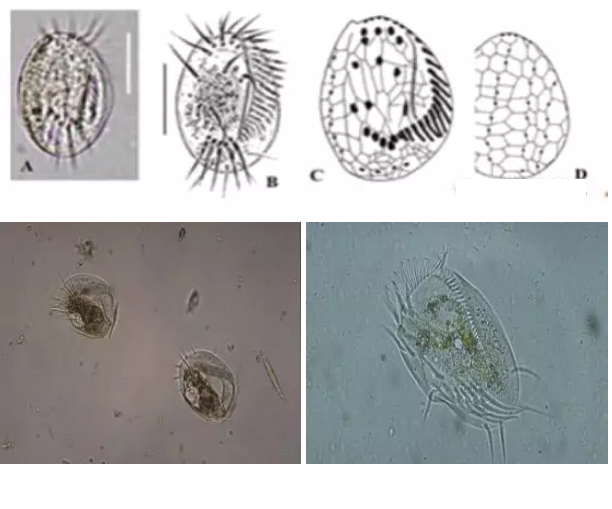 優質果殼濾料廠家污水處理指示性微生物大全!敏感者慎入