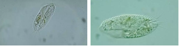 優質果殼濾料廠家污水處理指示性微生物大全!敏感者慎入