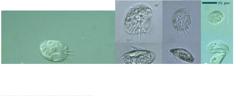 優質果殼濾料廠家污水處理指示性微生物大全!敏感者慎入