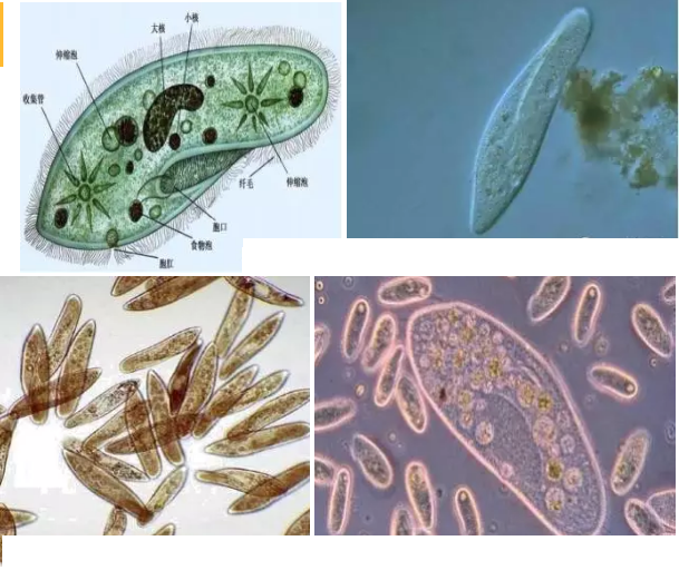 優質果殼濾料廠家污水處理指示性微生物大全!敏感者慎入