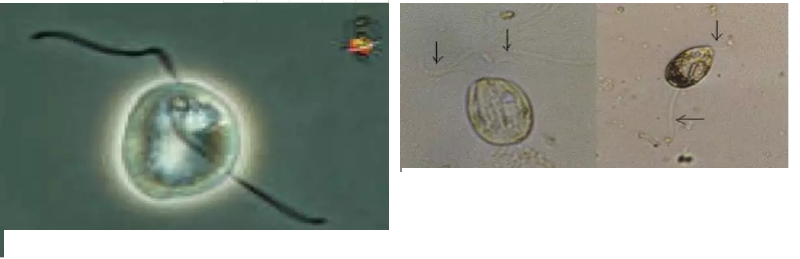 優質果殼濾料廠家污水處理指示性微生物大全!敏感者慎入