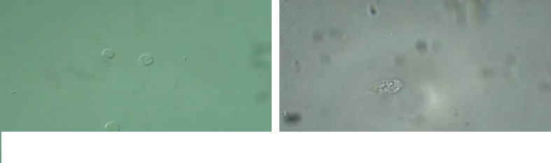 優質果殼濾料廠家污水處理指示性微生物大全!敏感者慎入