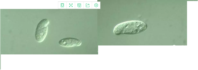 優質果殼濾料廠家污水處理指示性微生物大全!敏感者慎入