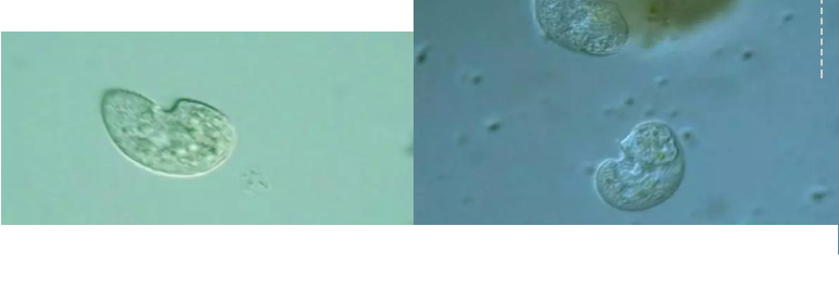 優質果殼濾料廠家污水處理指示性微生物大全!敏感者慎入