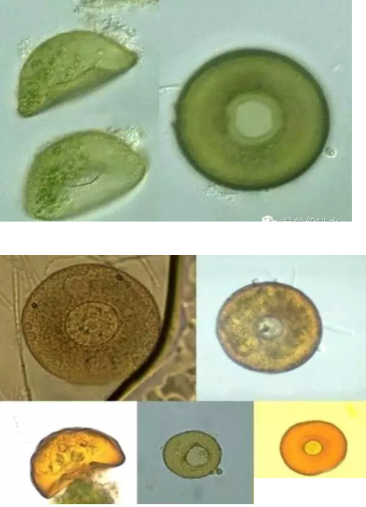 優質果殼濾料廠家污水處理指示性微生物大全!敏感者慎入