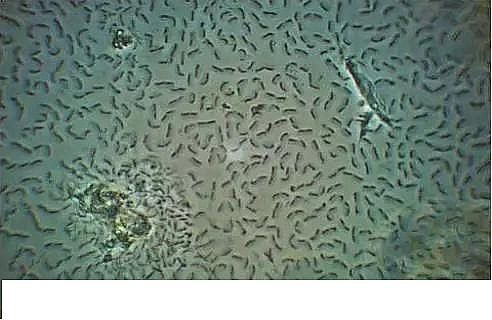 優質果殼濾料廠家污水處理指示性微生物大全!敏感者慎入