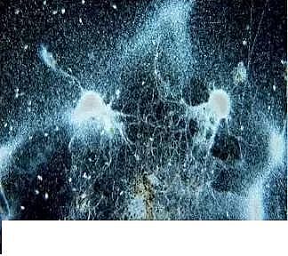 優質果殼濾料廠家污水處理指示性微生物大全!敏感者慎入