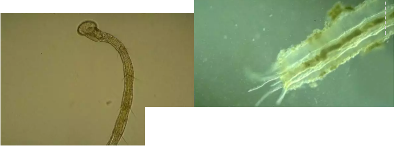 優質果殼濾料廠家污水處理指示性微生物大全!敏感者慎入