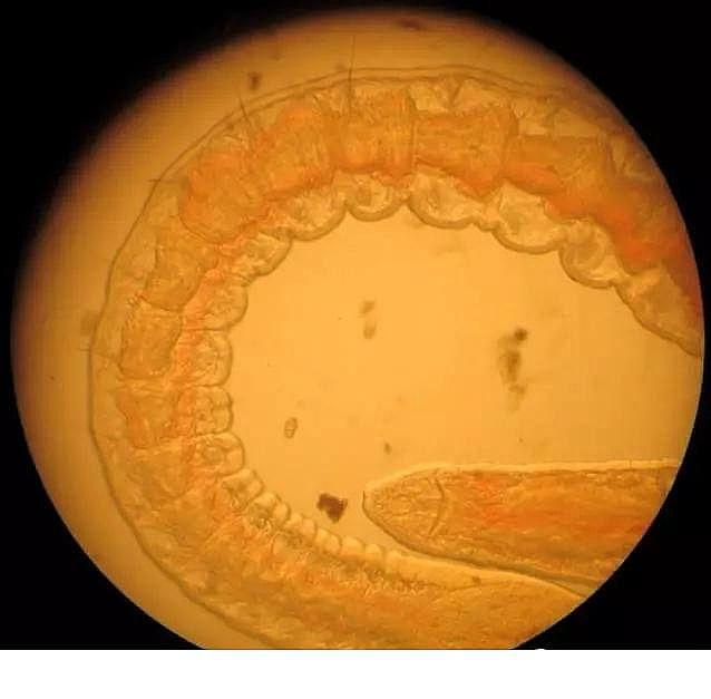 優質果殼濾料廠家污水處理指示性微生物大全!敏感者慎入
