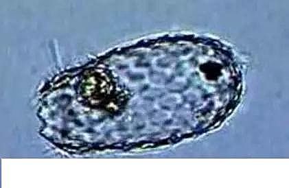 優質果殼濾料廠家污水處理指示性微生物大全!敏感者慎入