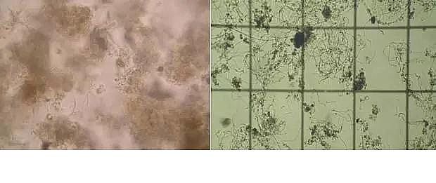 優質果殼濾料廠家污水處理指示性微生物大全!敏感者慎入