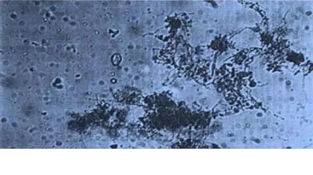 優質果殼濾料廠家污水處理指示性微生物大全!敏感者慎入