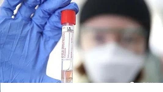 ú|(zh)w̿0.5-1mmSҰĴоˆT_l(f)zyˮCovid-19ϵy(tng)