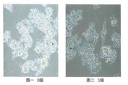 h(hun)۠̿SˮS(yng)Ûļg(sh)