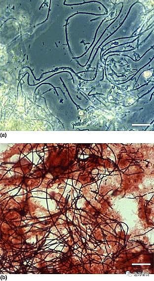 Ʒ|(zh)Ҭ̿SÛĭM. parvicellaĺ(jin)