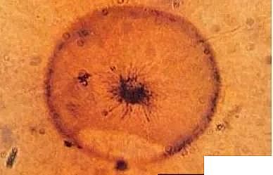 ߵiɰVϏSҷB͸ϵyiȾԭ̎÷